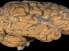 Neuroscienze tra cinema e realtà, a Locarno tre proposte in film e analisi