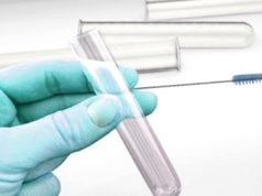 Influenza aviaria, due casi in Ticino. Rischio per le persone: quasi zero