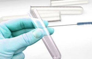 Influenza aviaria, due casi in Ticino. Rischio per le persone: quasi zero